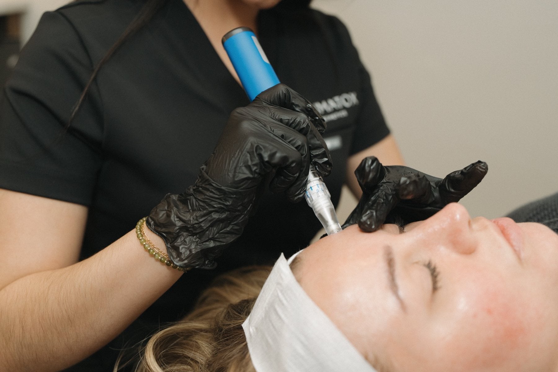 A skin treatment being performed at Illumatox in Neenah